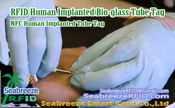 Rfid ch'íijsajil implantado bio-vidrio tubo u etiqueta u ka'anatako'ob yéetel perspectiva ma'alo'ob